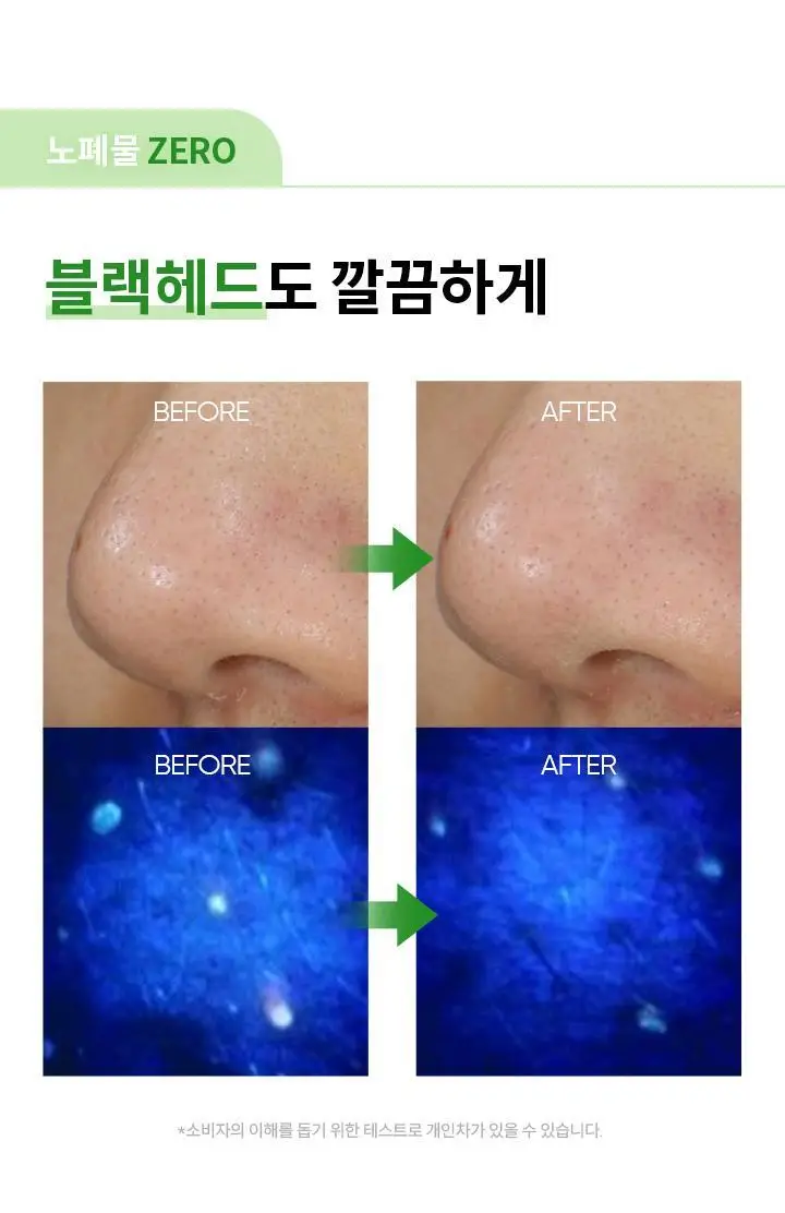 [블랙헤드 쏙] 바닐라코 클린잇제로 포어클래리파잉 클렌징밤 100ml 상세페이지 15